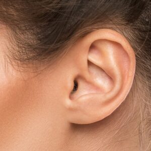 Transform Protruding Ears with Surgery