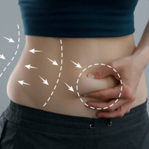 Tummy Tuck in Riyadh