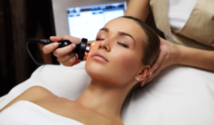 Laser Skincare Treatments