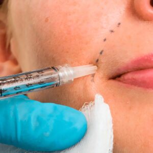 Permanent Skin Whitening Injection