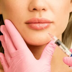 Juvederm Fillers