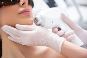 Laser Skincare Treatments