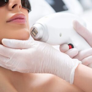 Laser Skincare Treatments