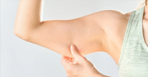 A Complete Transformation with Arm Lift Services