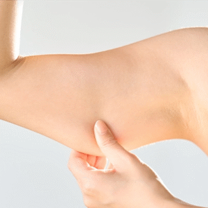 A Complete Transformation with Arm Lift Services