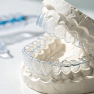 Clear Braces Treatment What Should I Do If I Lose a Tray