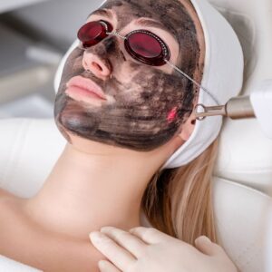 Gentle Yet Powerful Skin Renewal with Laser Carbon Peel