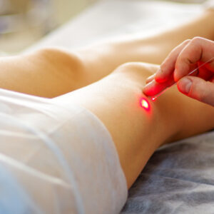 Gentle and Effective Varicose Veins Care