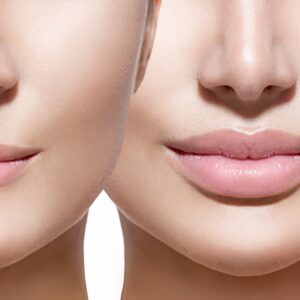 Lip Filler in Novi: Fuller, Natural-Looking Lips