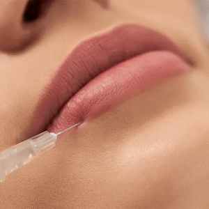 Safe and Advanced Russian Lip Filler Options