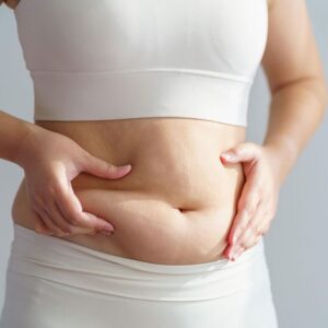 Tummy Tuck Surgery in Riyadh (