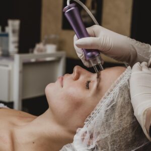microdermabrasion near me