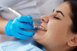 Teeth Cleaning in Dubai