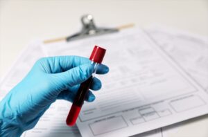 Blood Test at Home in Dubai