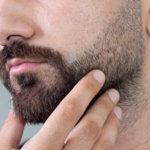 Beard Hair Transplant in Dubai