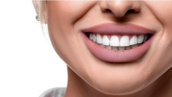 Hollywood Smile makeover in Dubai