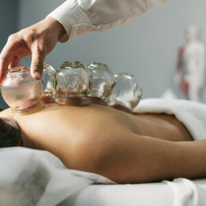 Cupping Therapy