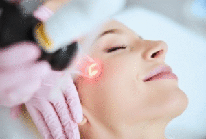 Best Affordable Laser Acne Scar Treatments