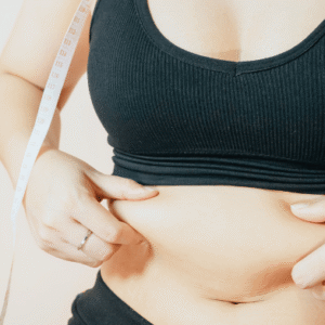 Liposuction in Dubai