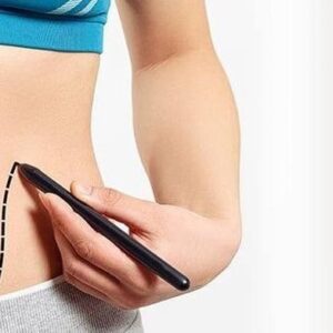 شفط الدهون في الرياض