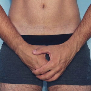 Long‑Lasting Results with the P Shot