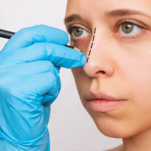 عملية تجميل الأنف في الرياض