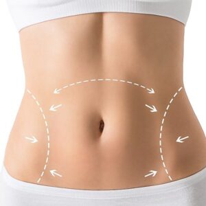 Tummy Tuck Surgery in Riyadh