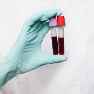 Blood Test at home in Dubai