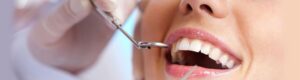 Teeth Cleaning in Dubai
