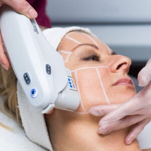 Laser hair Removal in Islamabad