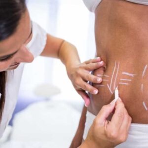 Body Contouring in Islamabad 2