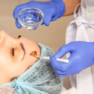 Deep Resurfacing Chemical Peels in Dubai