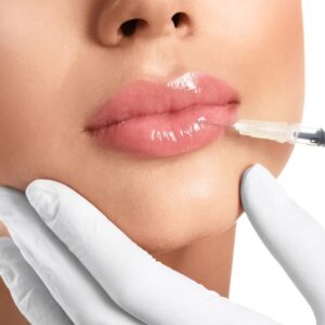 Enhance Natural Beauty with Russian Lip Fillers