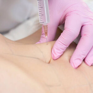 Fat melting injections in Dubai
