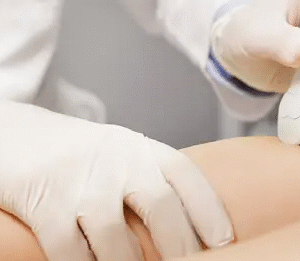 Improve Leg Comfort and Appearance with Modern Treatments