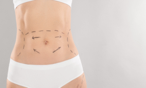 Is Waist Sculpting a Non Invasive Solution