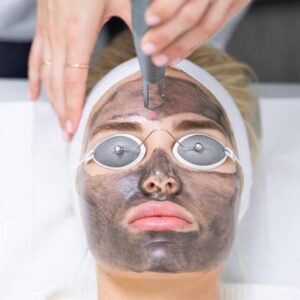 Laser Carbon Peel for Healthy, Radiant Skin