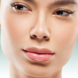 Long Lasting Results with Alarplasty