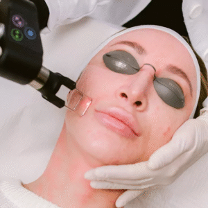 Modern Fractional Laser Care
