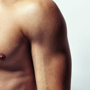 Professional Gynecomastia Treatment in a World-Class Setting
