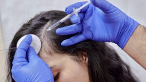 Regain Hair Confidence with G Cell Treatment