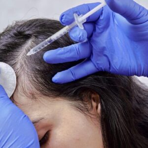 Regain Hair Confidence with G Cell Treatment