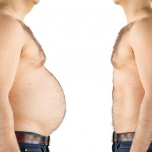 bariatric surgery in islamabad