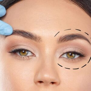 Eyelid Surgery in Islamabad