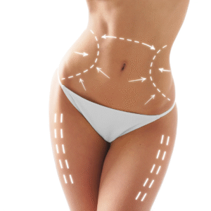 Achieve a Toned Silhouette with SculpSure