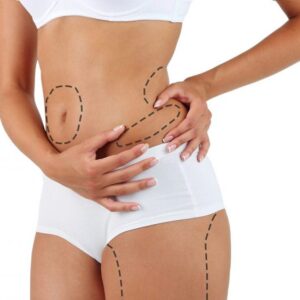 Advanced Waist Sculpting Solutions for Men and Women