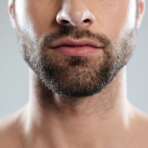 Beard Hair Transplant in Islamabad
