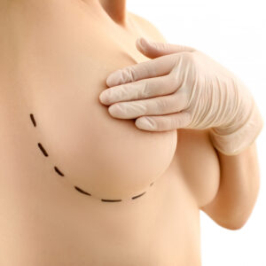 Breast Implants Crafted for Long-Lasting Satisfaction