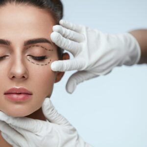 Eyelid Surgery Blepharoplasty 1